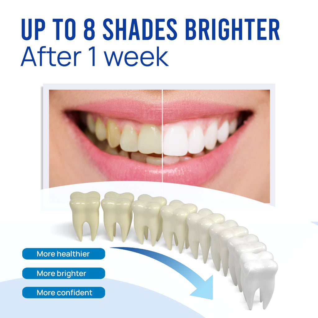 Professional Teeth Whitening Pen Remove Years of Stains VieBeauti