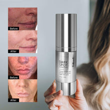 use Dark Spot Remover Serum before and after